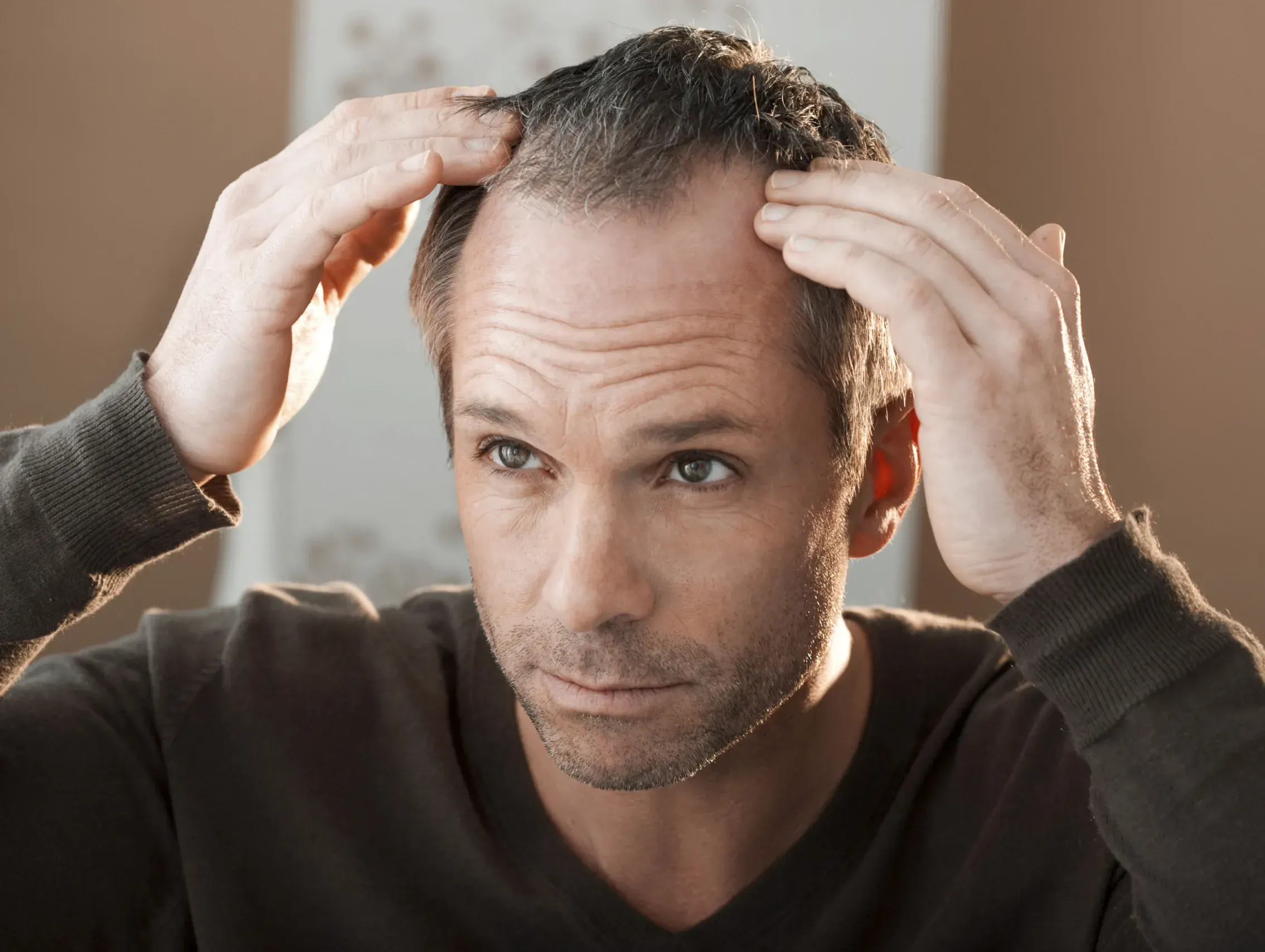 Signs You May Be Experiencing <span>Alopecia</span>