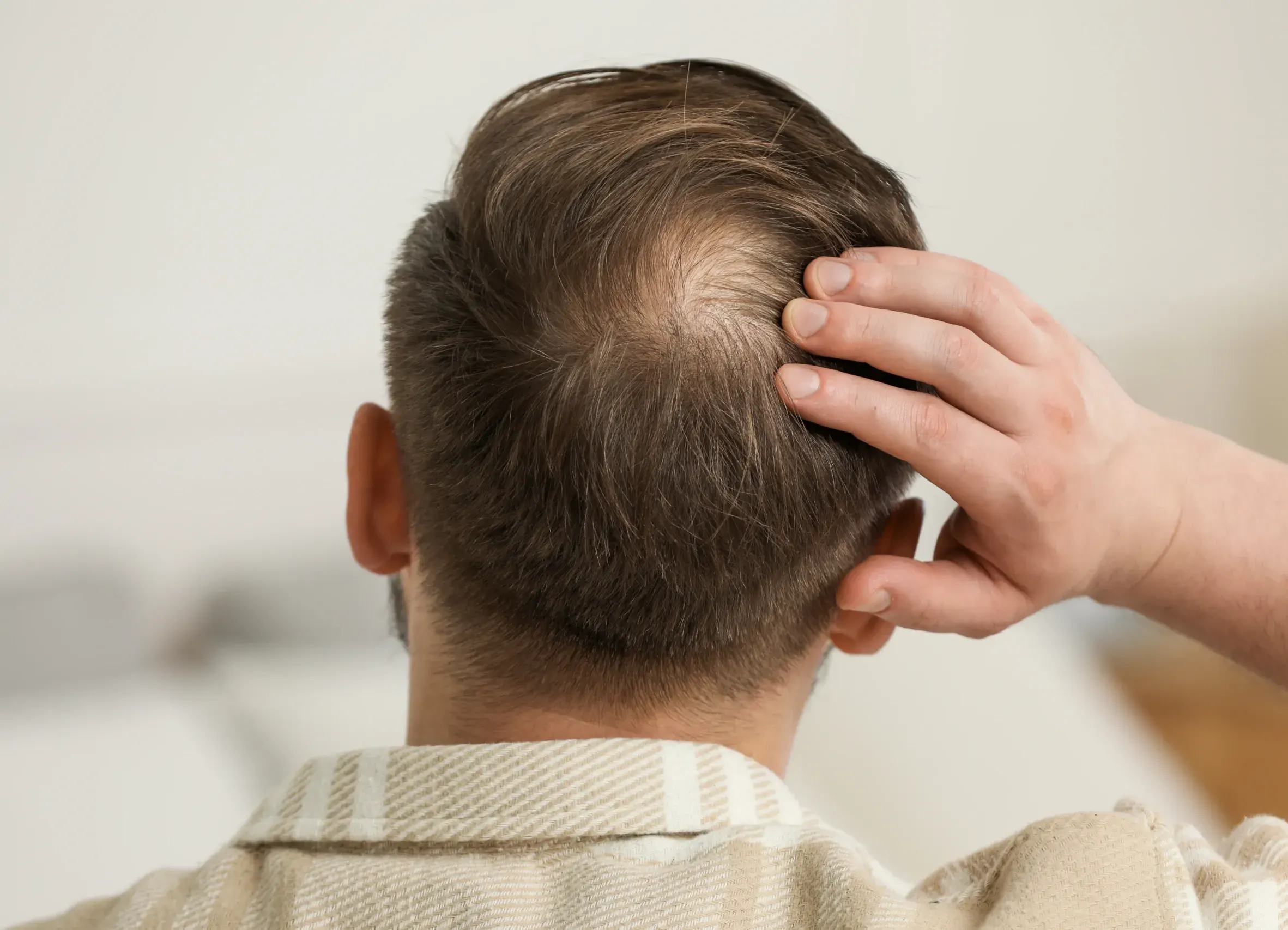 Signs You May Be Experiencing <span>Diffuse Thinning</span>