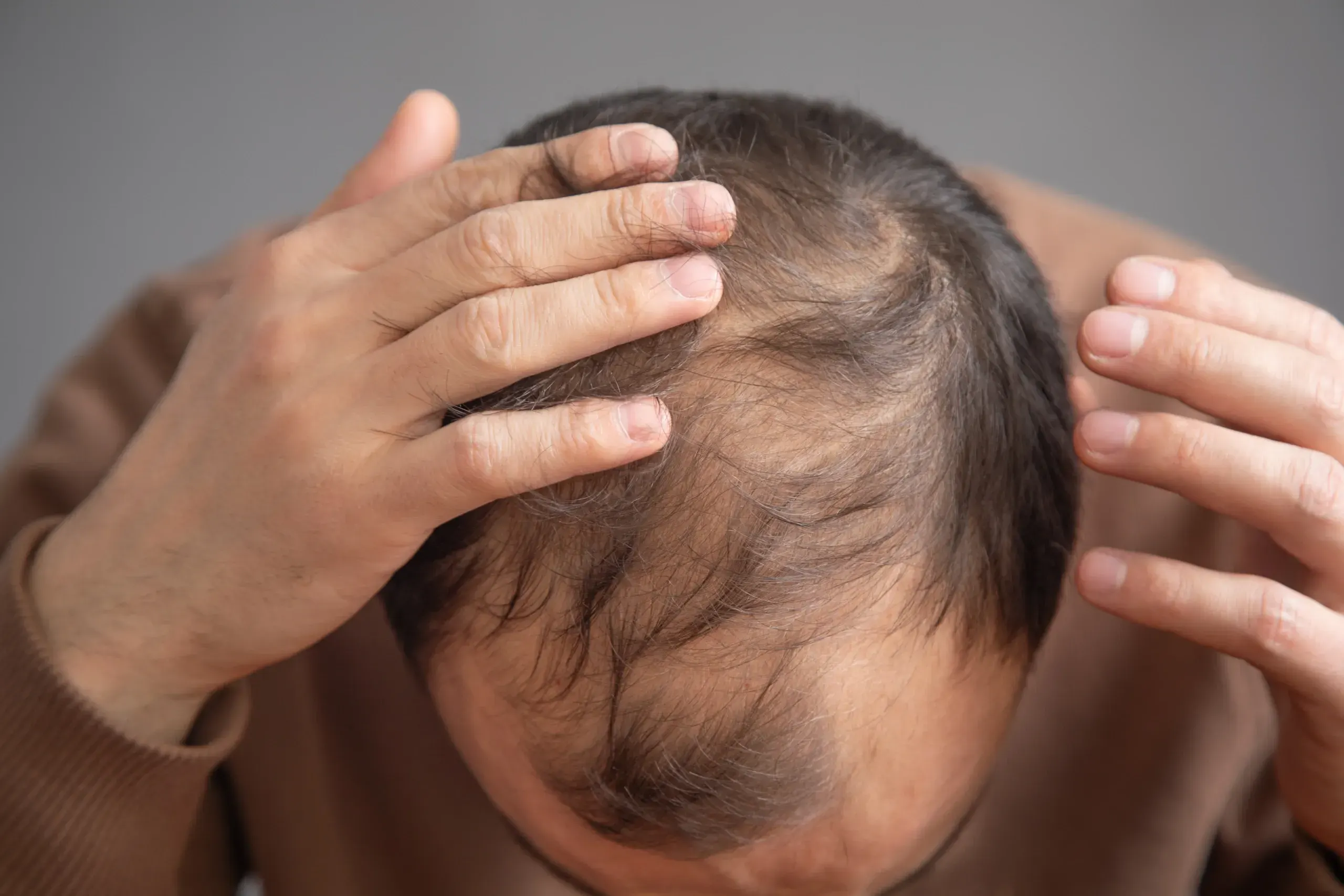 Diffuse Thinning