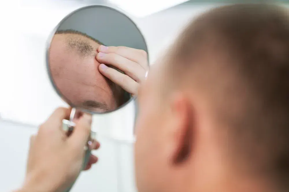Finasteride & Minoxidil FAQ in Illinois