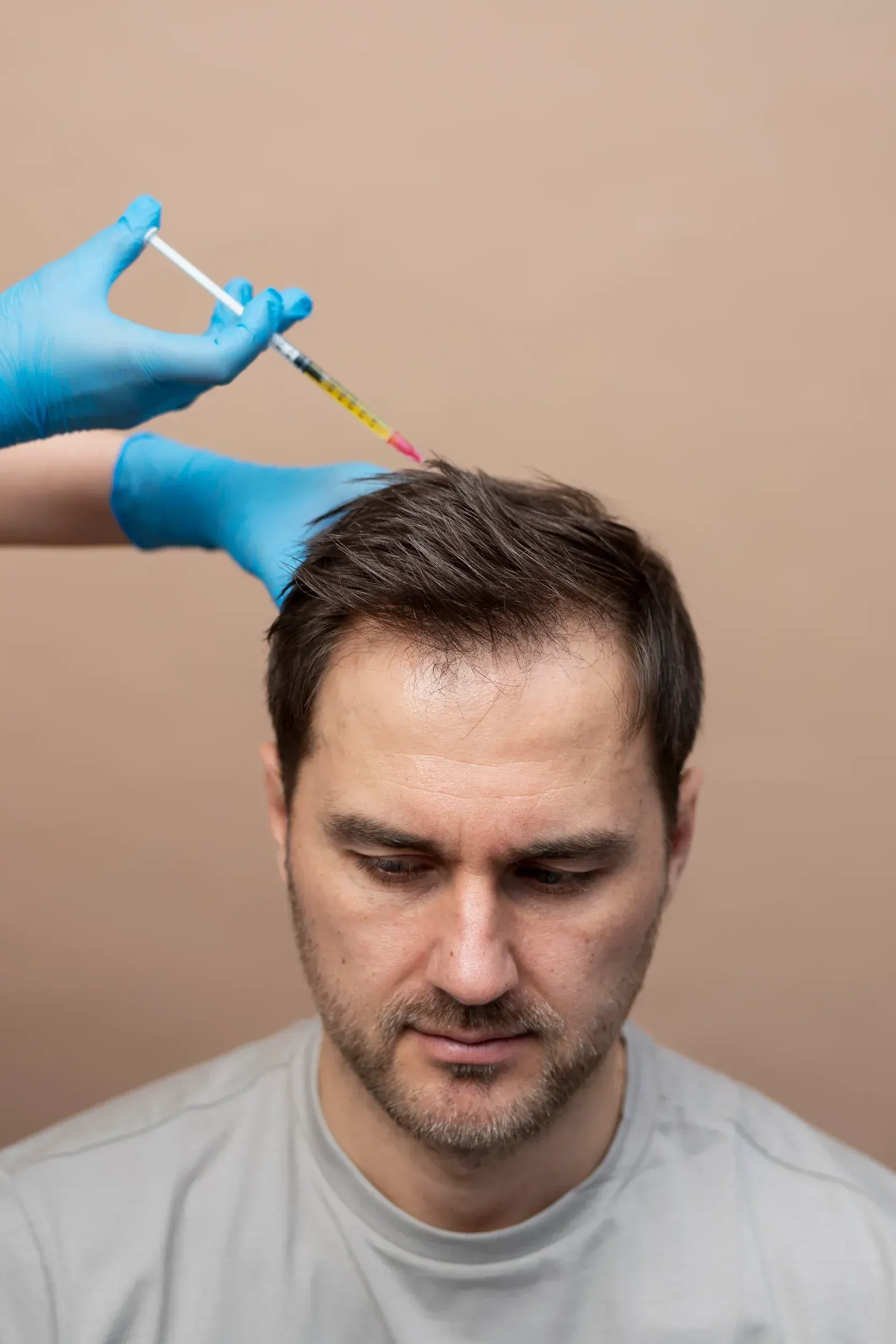 PRP centrifuge and platelet-rich plasma preparation at DSI Hair