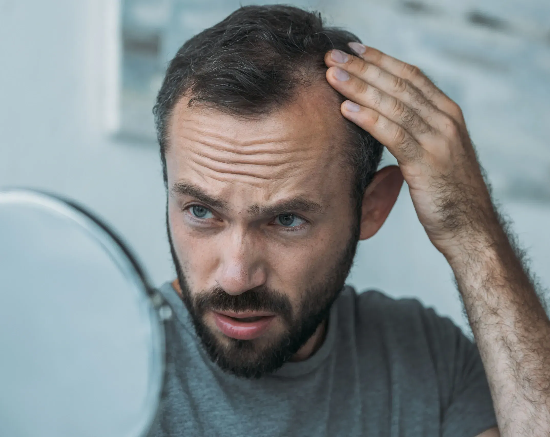 Signs of Balding: Early Detection and Treatment Options