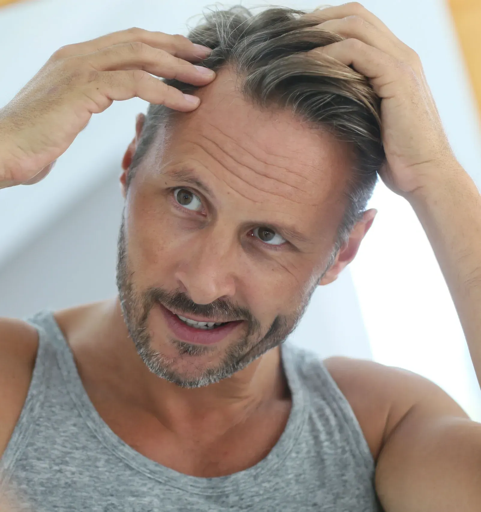 Why Your Hairline Is <span>Receding</span> - and What You Can Do About It