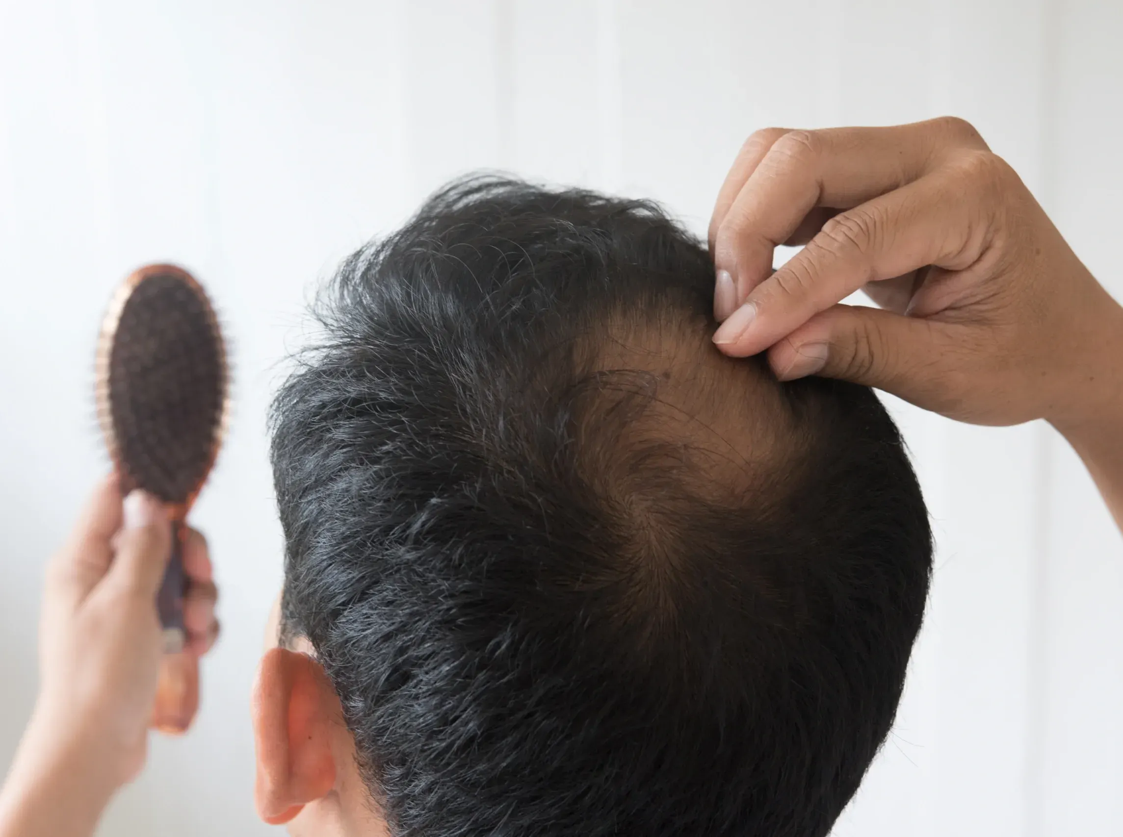 Why Is My <span>Hair Thinning</span>?